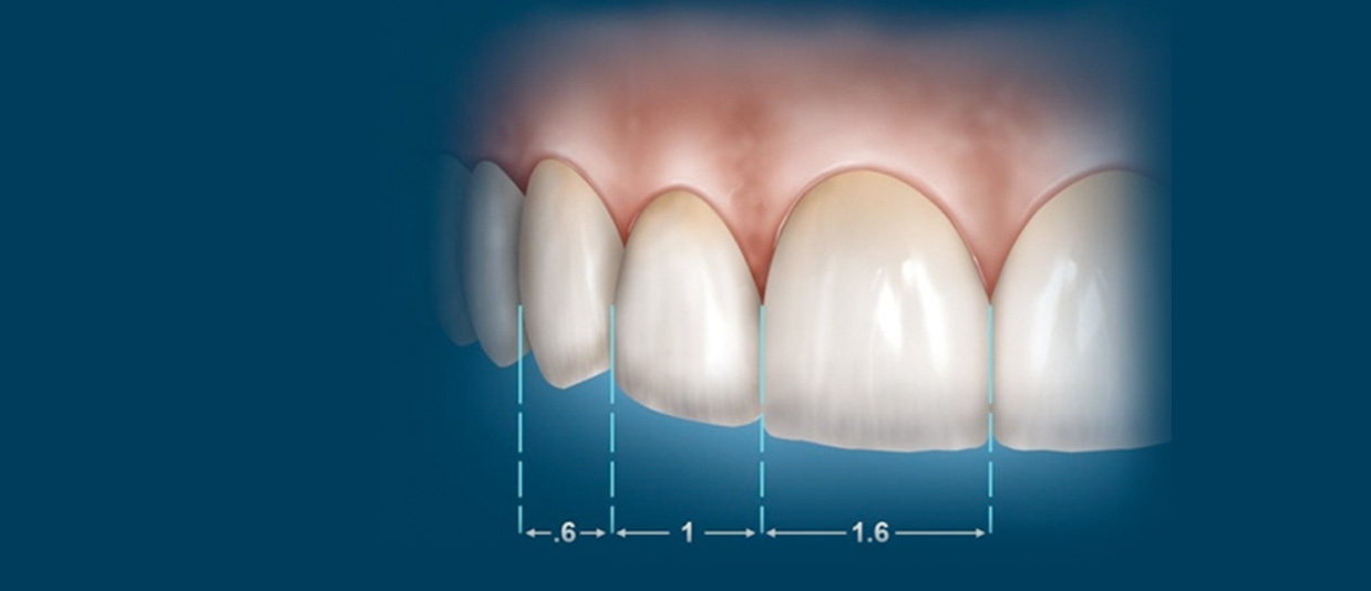 Estetik Diş Hekimliği Nedir?
