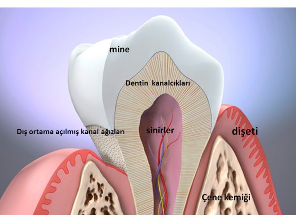 Diş Hassasiyeti Nedir